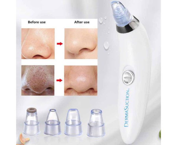 Derma Suction 4-in-1 | Blackhead Remover, Pore Cleaner & Acne Vacuum Tool!