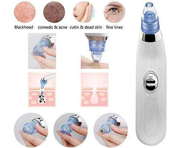 Derma Suction 4-in-1 | Blackhead Remover, Pore Cleaner & Acne Vacuum Tool!