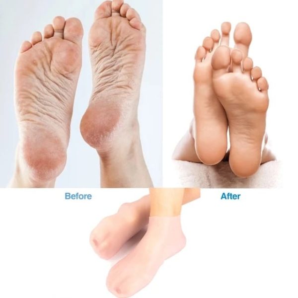 Silicone Gel Moisturizing Socks | Ultimate Foot Care & Protection!